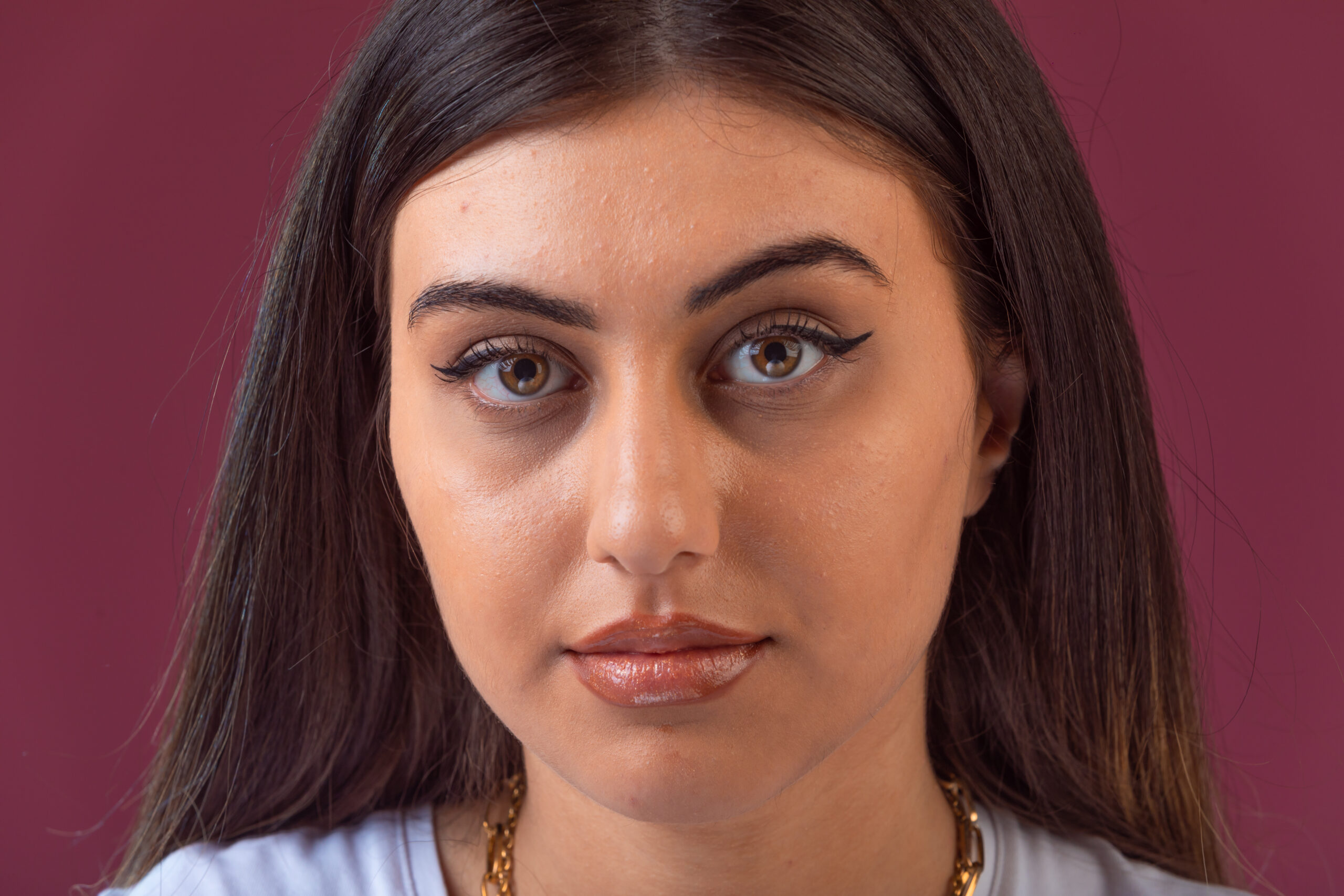 Middle Eastern with dark circles on her under eyes